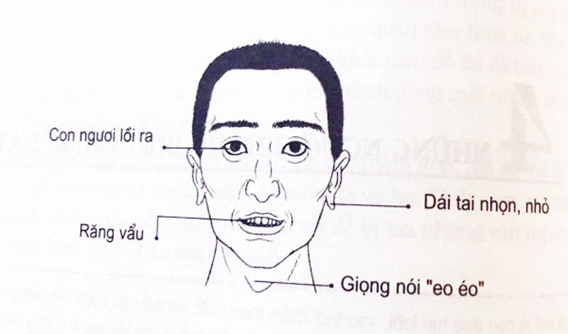 tướng mạo, trăng hoa, đàn ông, 